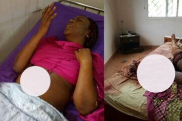 Birababaje:Umugore yakase igitsina cy’ umugabo nyuma bamufata agiye kwiyahura [ REBA AMAFOTO]