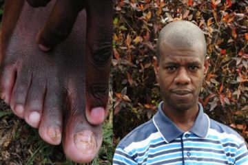 Venant Musoni  wakorewe  iyicarubozo muri Uganda, aratabariza  bagenzi be 40 bari mu makasho ko bakorerwa ubuvugizi