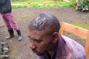 Umunyarwanda yajugunwe ku Mupaka wa Cyanika yagizwe intere